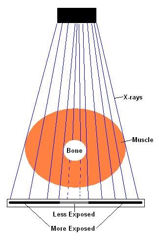 X-ray exposure monitoring X-ray exposure monitoring